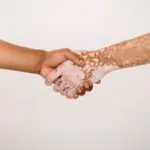 Psoriasi e artrite psoriasica: la riunione scientifica dell’Accademia Medicina di Torino